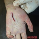 Examination and autopsy of female victim of machete attack