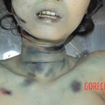 Examination and autopsy of female victim of machete attack