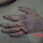 Examination and autopsy of female victim of machete attack