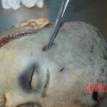 Examination and autopsy of female victim of machete attack