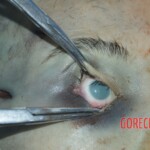 Examination and autopsy of female victim of machete attack