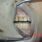 Examination and autopsy of female victim of machete attack