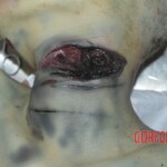 Examination and autopsy of female victim of machete attack