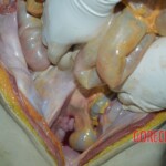 Examination and autopsy of female victim of machete attack