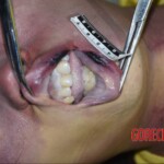 Examination of dead Chinese woman