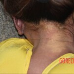 Examination of dead Chinese woman