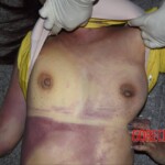 Examination of dead Chinese woman