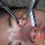 Examination of dead Chinese woman