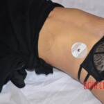 Examination of suicide victim