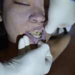 Examination of suicide victim