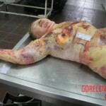 Female fire victim in morgue
