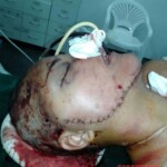 Woman has nearly her entire face torn off after car crash