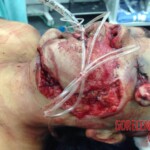 Woman has nearly her entire face torn off after car crash