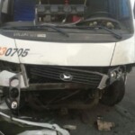 Woman has nearly her entire face torn off after car crash