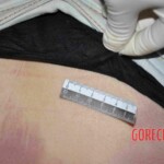 Young chinese female stabbed by boyfriend