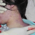 Young chinese female stabbed by boyfriend