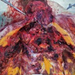 Elderly Russian couple died in bus accident