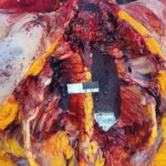 Elderly Russian couple died in bus accident