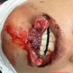 Man bit off his girlfriend’s lower lip