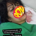 Man bit off his girlfriend’s lower lip