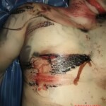 Murder of Travis Alexander