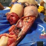 Portuguese man trapped under train suffered serious injuries