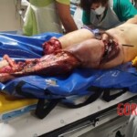 Portuguese man trapped under train suffered serious injuries