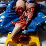 Portuguese man trapped under train suffered serious injuries
