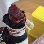 Vietnamese man lost his hand in machete attack