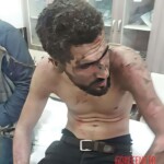 Aftermath of car bombing in Afrin, Syria