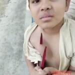 Boy accidentally got impaled on sharp metal railing