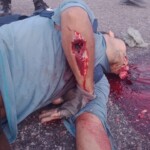 Someone shot his brain out of his head