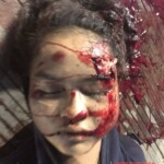 Two young Cambodian women died in traffic accident