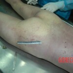 Chinese woman raped and murdered by sexual deviant