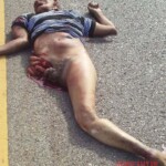 Collision with car tore off pedestrian's entire leg