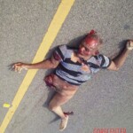 Collision with car tore off pedestrian's entire leg