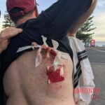 Terrorist attack on Bondi Beach in Sydney