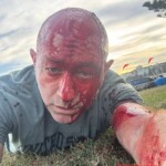 Terrorist attack on Bondi Beach in Sydney