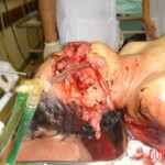 Woman mutilated by own pitbull