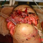 Woman mutilated by own pitbull