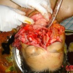 Woman mutilated by own pitbull