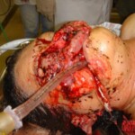 Woman mutilated by own pitbull