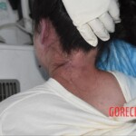 Chinese woman suddenly died during transport in ambulance