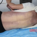 Chinese woman suddenly died during transport in ambulance