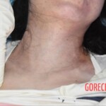 Chinese woman suddenly died during transport in ambulance