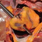 Husband stabbed her in heart during argument