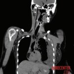 Husband stabbed her in heart during argument