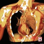 Husband stabbed her in heart during argument