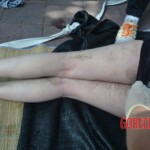 Initial examination of body of drowned Chinese woman