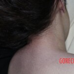 Initial inspection of deceased woman's body